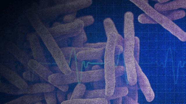 Possible tuberculosis exposure at MacArthur High School