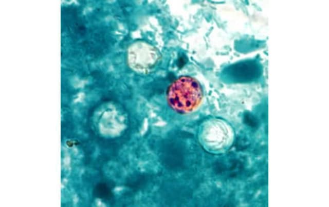 Health Department reports 2 new travel-related cyclosporiasis cases in Hawaii
