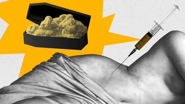 GLP-1s are shrinking bodies. Enter cadaver fat injections
