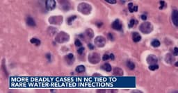 Brain-eating amoeba, flesh-eating bacteria: What NC swimmers should know this Labor Day