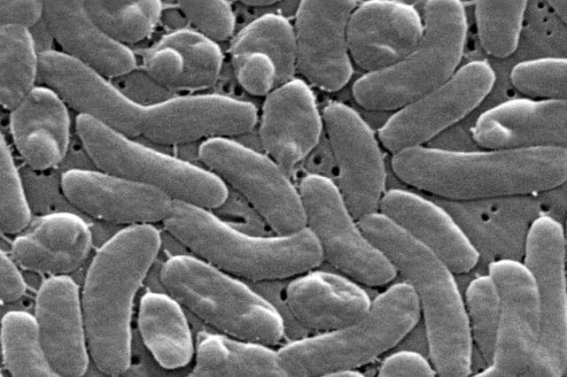Louisiana health officials warn beachgoers of flesh-eating bacteria risk
