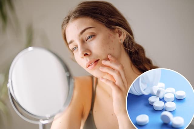 'Ferritin face,' the mineral deficiency messing with your looks