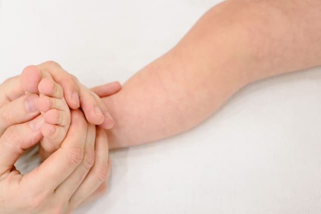 Los Angeles County confirms seventh measles case of the year