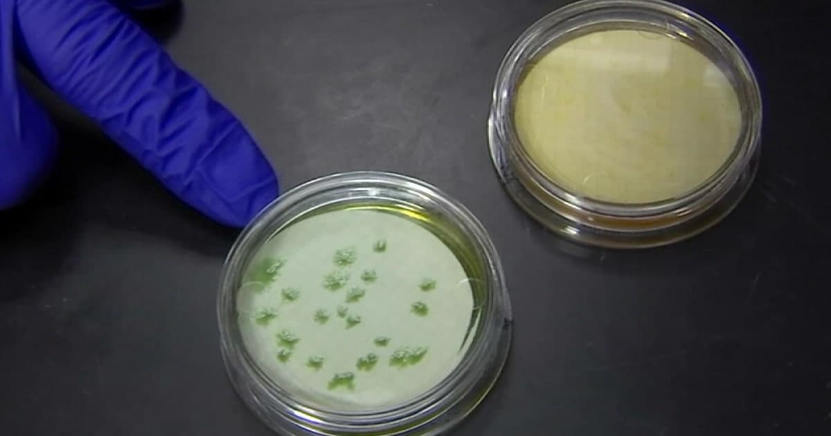 Pinellas County resident dies from Vibrio vulnificus: FDOH