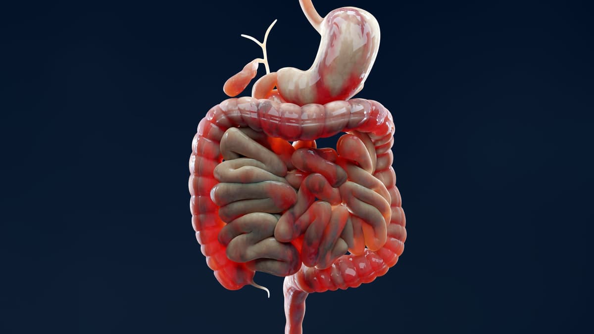 Why Does IBD Keep Flaring Up? Scientists Found a Clue in The Gut Lining
