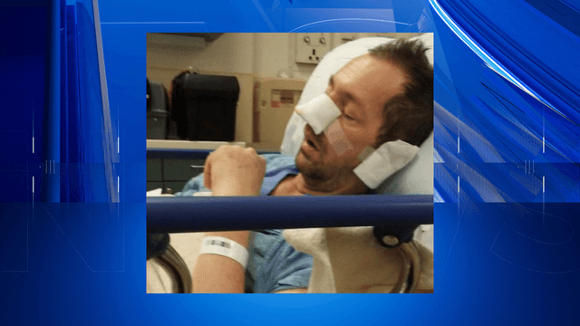 Former motocross rider shares how opioid addiction led to fentanyl use, sepsis, and the loss of his nose
