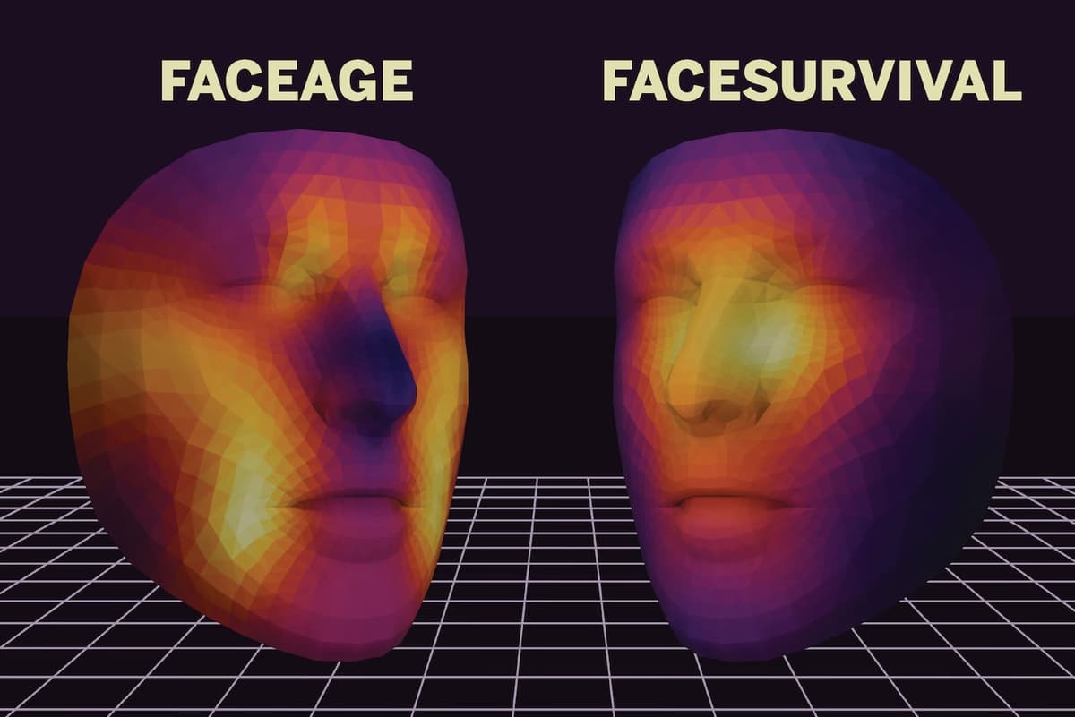 Anyone can now upload photos to try Mass General’s FaceAge tool