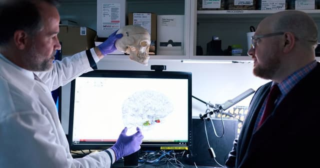 Alzheimer’s researchers look at an unusual data point: Head shape