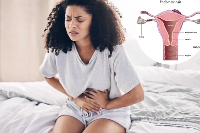 What are the lesser-known symptoms of endometriosis